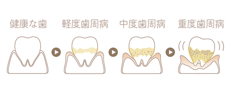 この段階での治療イメージ